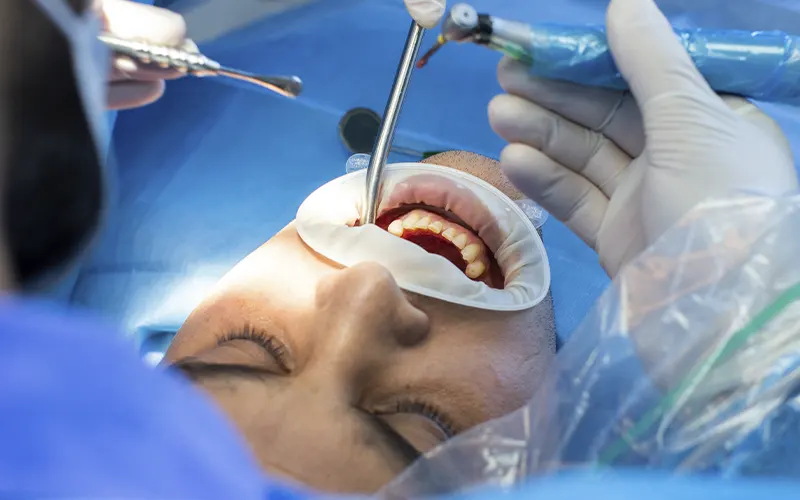 Cirurgia oral São José dos Pinhais